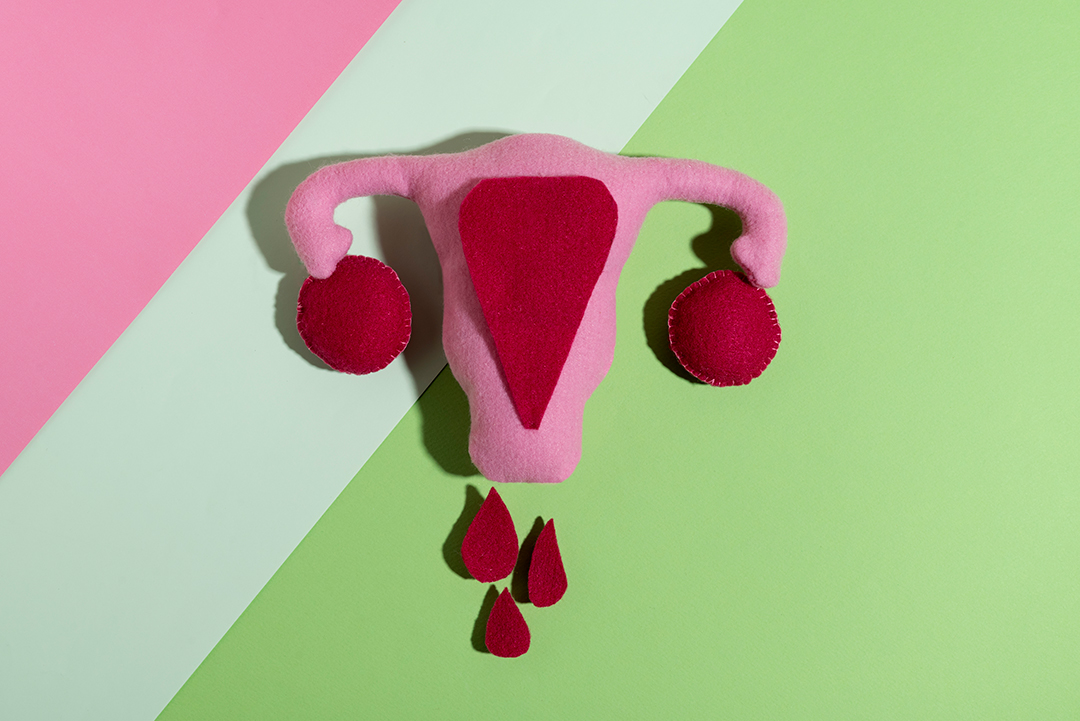 출혈을 표현한 자궁 모형 사진