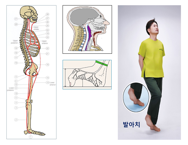 발아치 걷기 운동